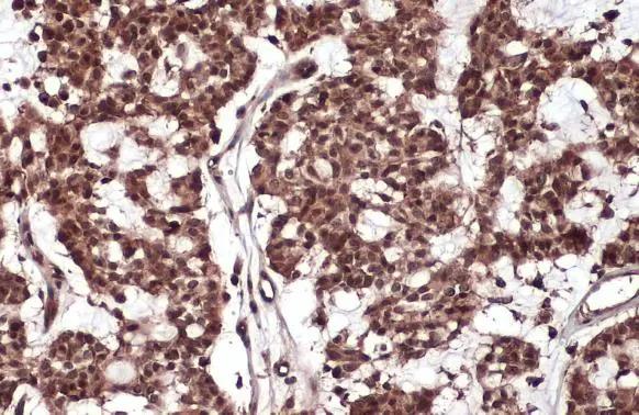 RelB Antibody