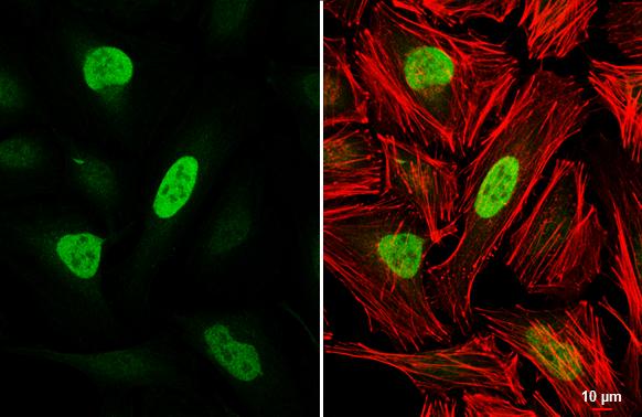 RB1 Antibody - BSA Free