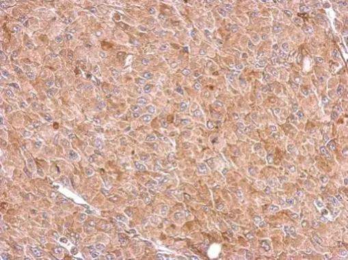 RIOK3 Antibody