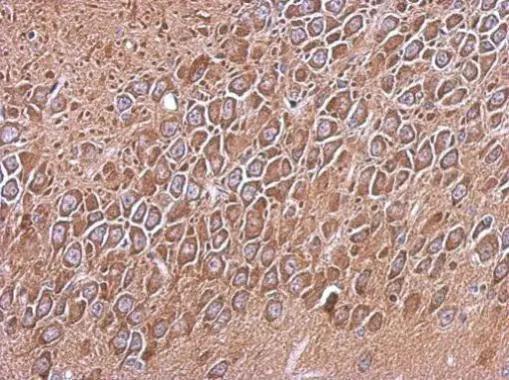 RP105/CD180 Antibody