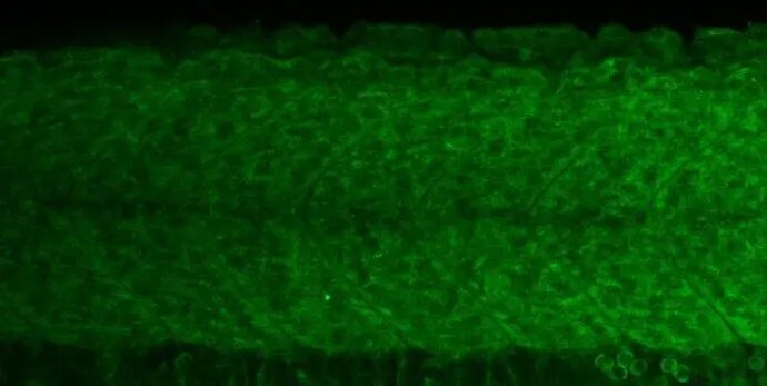 RPL11 Antibody