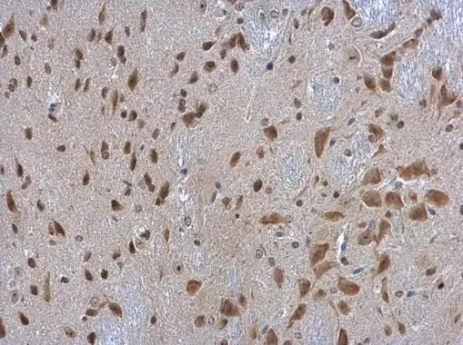 RPL3 Antibody