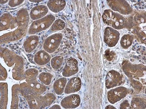 RPL3 Antibody