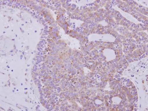 RPL6 Antibody