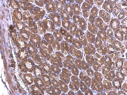 RPL6 Antibody