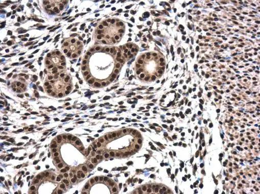 RPRD1B Antibody - BSA Free