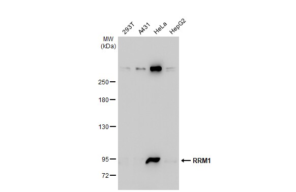 RRM1 Antibody