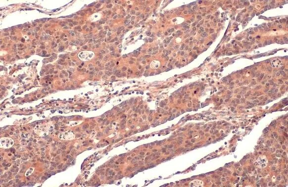 RRM1 Antibody