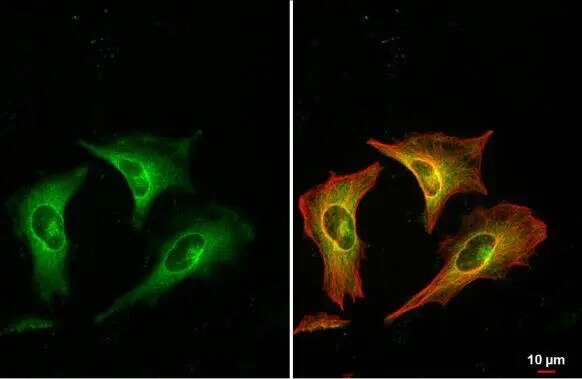 RRM1 Antibody
