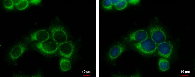 RRM1 Antibody - BSA Free