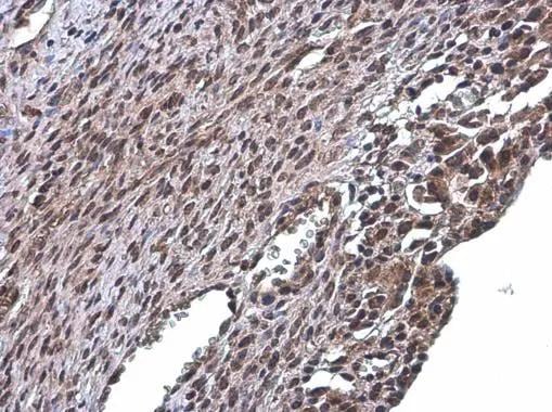 RSK2 Antibody