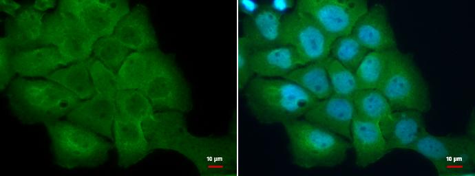 S100A2 Antibody - BSA Free