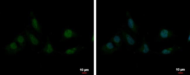 SAP130 Antibody