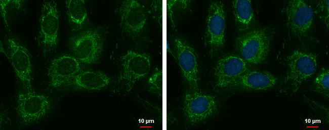 SARS2 Antibody - BSA Free