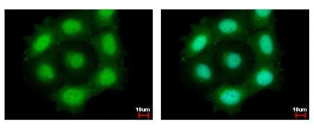 PTTG1 Antibody