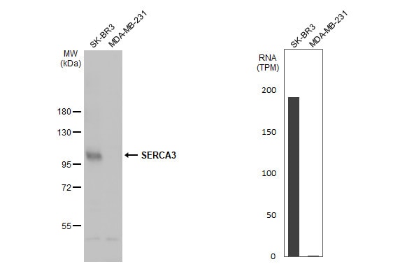 SERCA3 ATPase Antibody - BSA Free