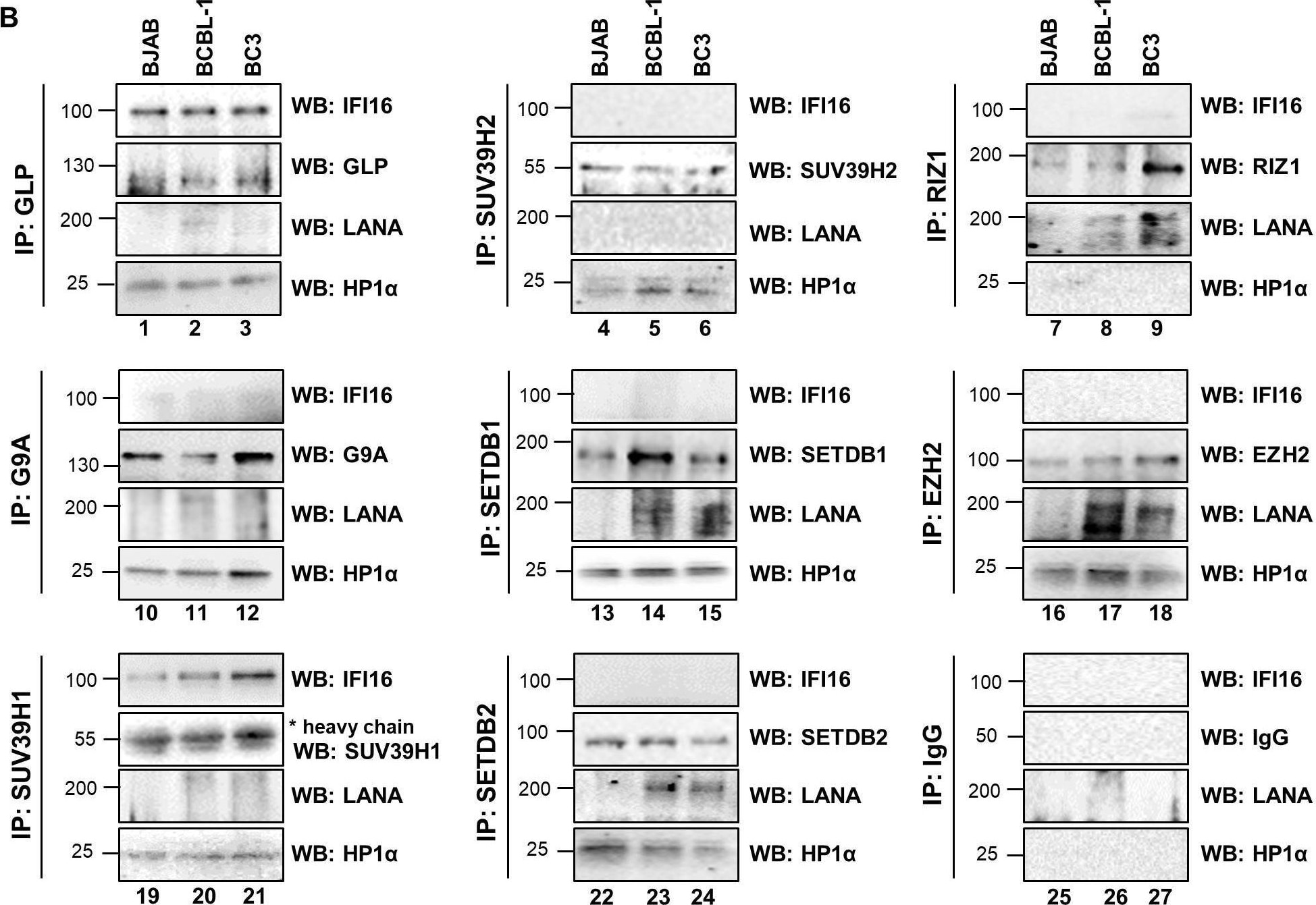 SETDB1 Antibody - BSA Free