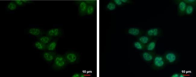 SETDB2 Antibody - BSA Free