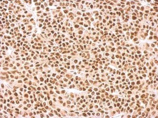 SF2 Antibody