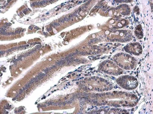 SH3BP1 Antibody - BSA Free