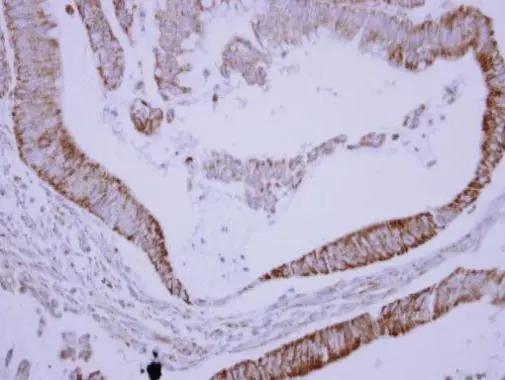 SH3BP5 Antibody - BSA Free
