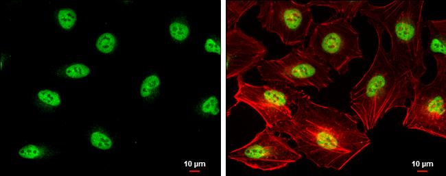 SIN3B Antibody - BSA Free