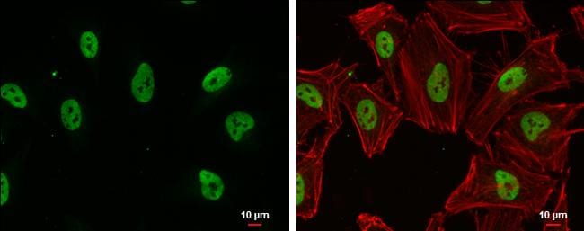 SIN3B Antibody - BSA Free