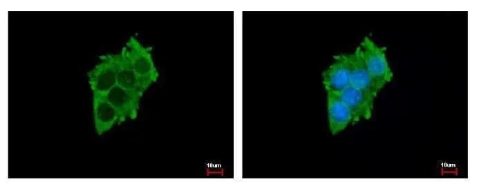 Sialin/SLC17A5 Antibody - BSA Free