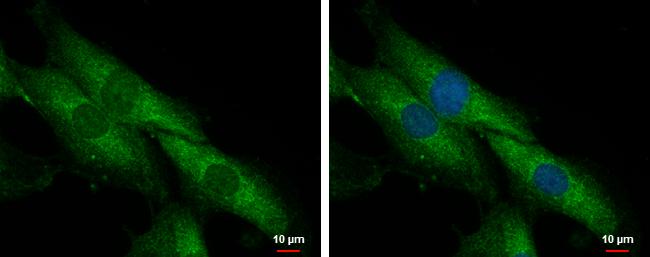 SLC25A23 Antibody - BSA Free