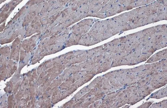 SLC25A6 Antibody