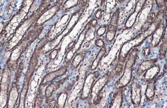 SLC25A6 Antibody