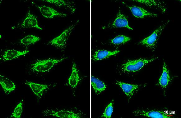 SLC25A6 Antibody