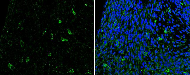 Slit2 Antibody - BSA Free