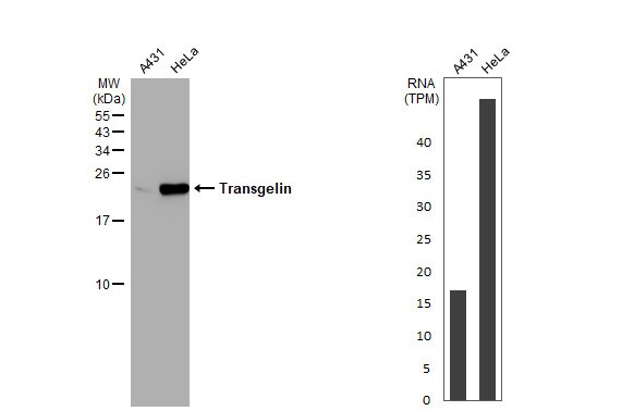 Transgelin/TAGLN/SM22 alpha Antibody