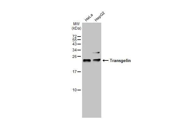 Transgelin/TAGLN/SM22 alpha Antibody
