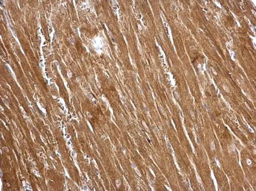 Transgelin/TAGLN/SM22 alpha Antibody - BSA Free