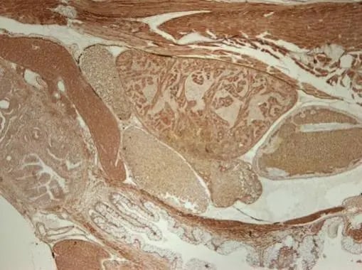 Smad5 Antibody