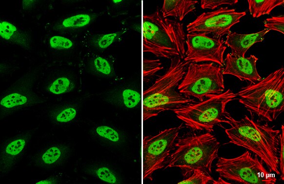 SMARCC1 Antibody