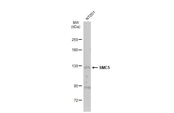 SMC5 Antibody - BSA Free