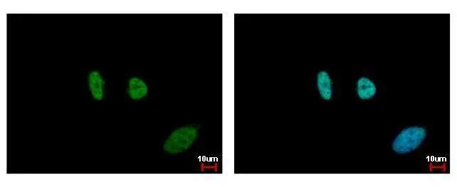 SMC6L1 Antibody