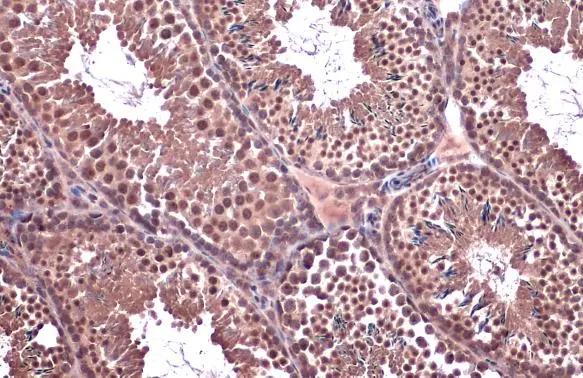 SMC6L1 Antibody