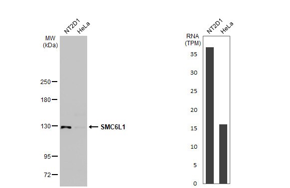 SMC6L1 Antibody