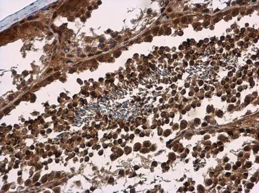 SMG7 Antibody