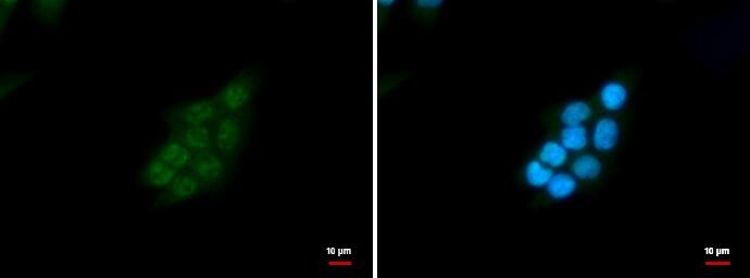 SNRPD2 Antibody