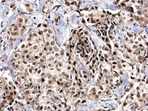 SNRPD2 Antibody