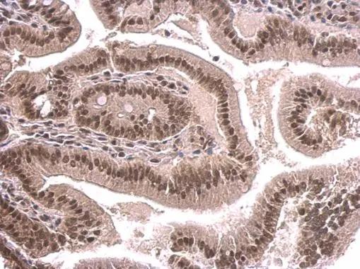 SNRPD2 Antibody