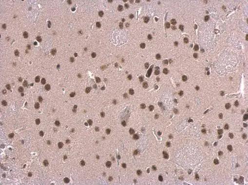 SNRPD2 Antibody