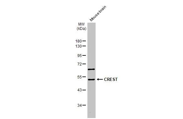 SS18L1 Antibody - BSA Free