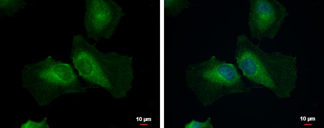 AMSH-LP Antibody