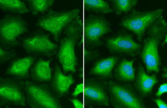 STAT6 Antibody